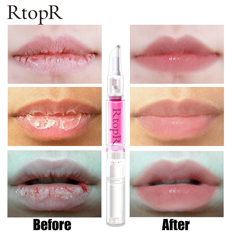 CHERRY BLOSSOM LIP SERUM - PEELING REPAIR LIPS