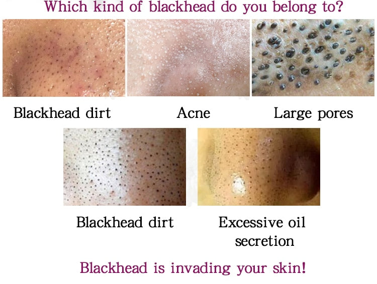 GOLD BLACK FACE MASK
