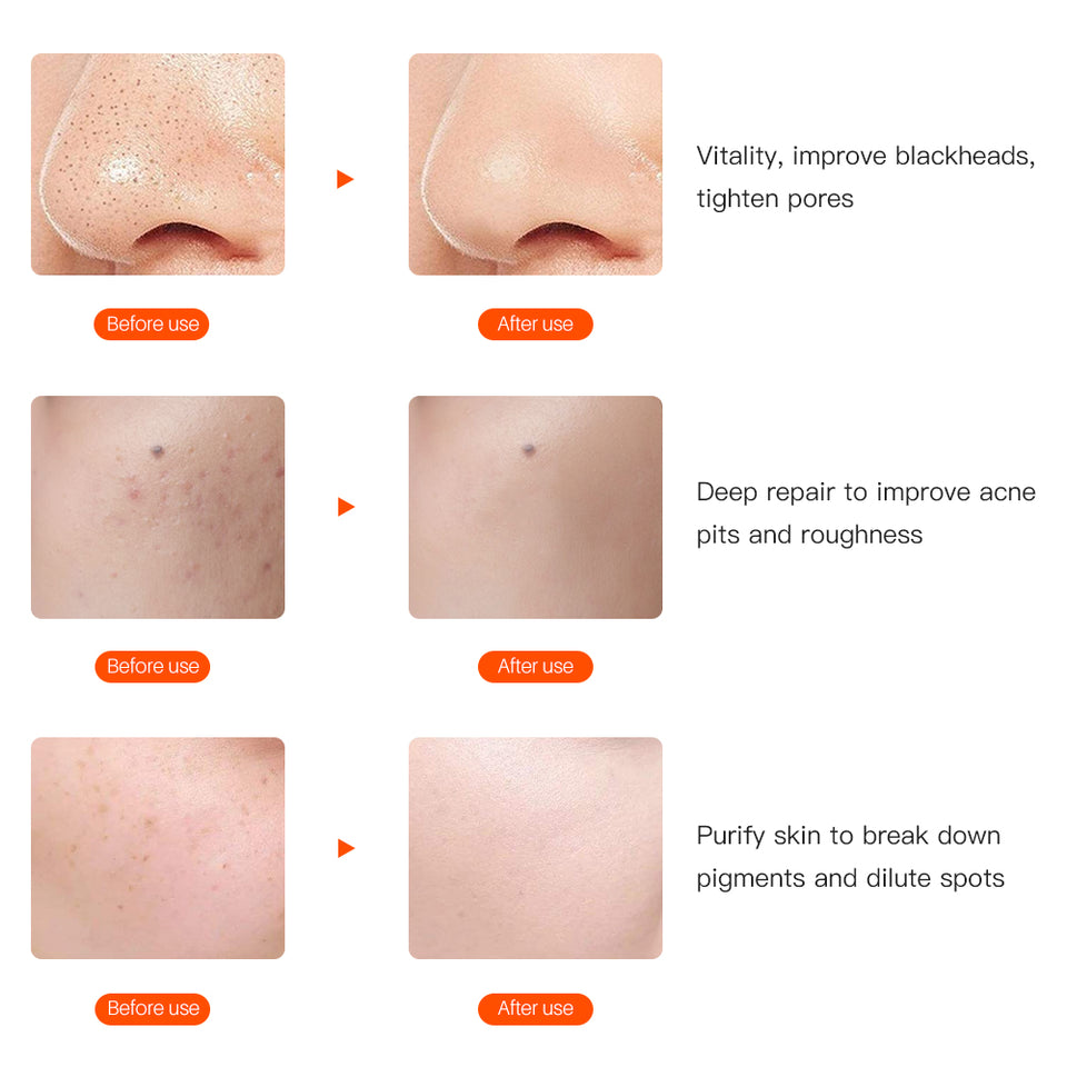 LED FACIAL MASK THERAPY 7 COLORS FACE MASK MACHINE PHOTON THERAPY LIGHT SKIN CARE WRINKLE ACNE REMOVAL FACE BEAUTY FOR HOME USE