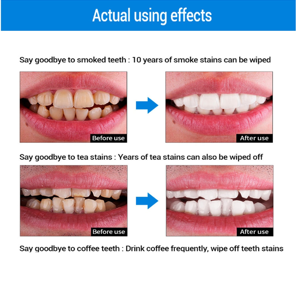 Oral Hygiene Cleaning Serum Removes Plaque Stains