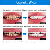 Oral Hygiene Cleaning Serum Removes Plaque Stains